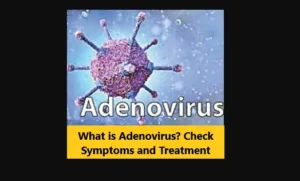 Read more about the article What is Adenovirus? Check Symptoms and Treatment
