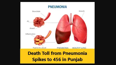 You are currently viewing Death Toll from Pneumonia Spikes to 456 in Punjab