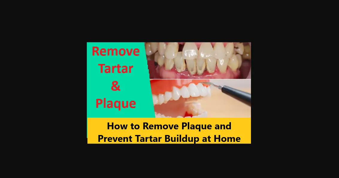 Read more about the article How to Remove Plaque and Prevent Tartar Buildup at Home