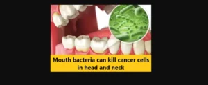 Read more about the article Mouth bacteria can kill cancer cells in head and neck